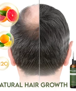 FolliBoost Hair Regrowth Spray