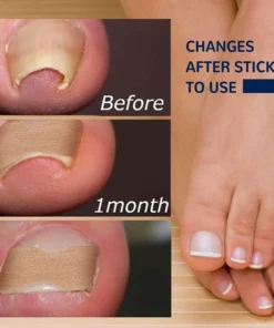 German ToenailHeal Paronychia Relief Patch