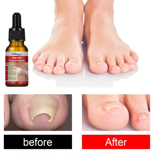 German ToenailPlus™ Anti Paronychia Relief Oil