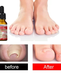 German ToenailPlus™ Anti Paronychia Relief Oil