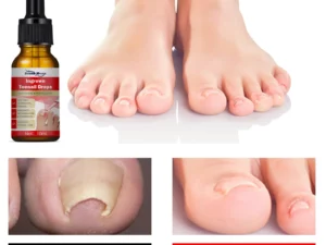 German ToenailPlus™ Anti Paronychia Relief Oil