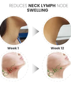 GooLiving AntiHump Lymphcare Ginger Ointment