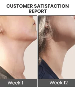 GooLiving AntiHump Lymphcare Ginger Ointment