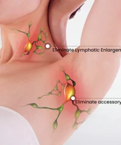 GooLiving AntiHump Lymphcare Ginger Ointment