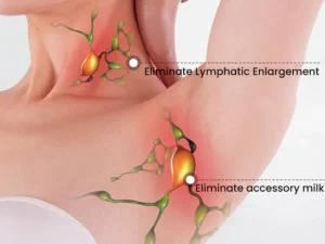 GooLiving AntiHump Lymphcare Ginger Ointment