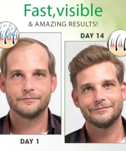 GrowthMax™ Red Ginseng Hair Spray