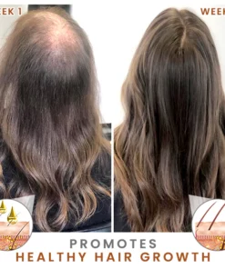 HOVO Hair Density Essential Oil