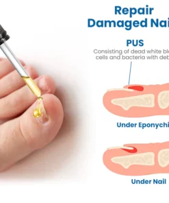 Harivian® Anti Paronychia Relief Oil