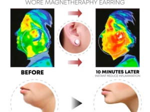 HealBio® Titanium Lymphvity MagneTherapy EarStuds