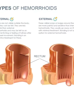 HemorrHeal Herbal RapidRelief Ointment