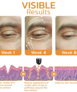 Hyaluronic Expert Energetic Eye Roller