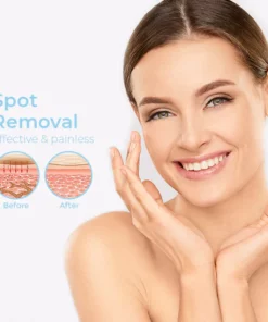 InstaCLEAR™ Spots Removal Pen