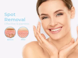 InstaCLEAR™ Spots Removal Pen