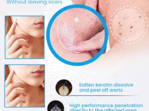 Instant PLUS Wart Removal Ointment