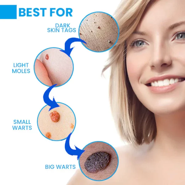 Ungüento Eliminador de Verrugas Instant PLUS
