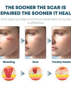 Instant ScarRemoval Advanced Gel