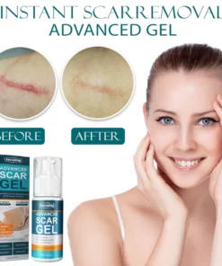 Instant ScarRemoval Advanced Gel