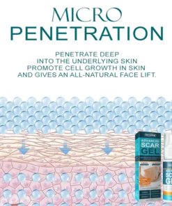 Instant ScarRemoval Advanced Gel