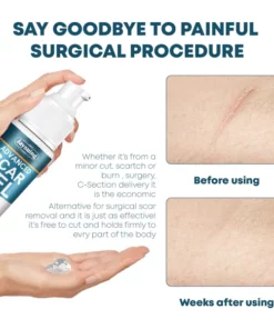 Instant ScarRemoval Advanced Gel