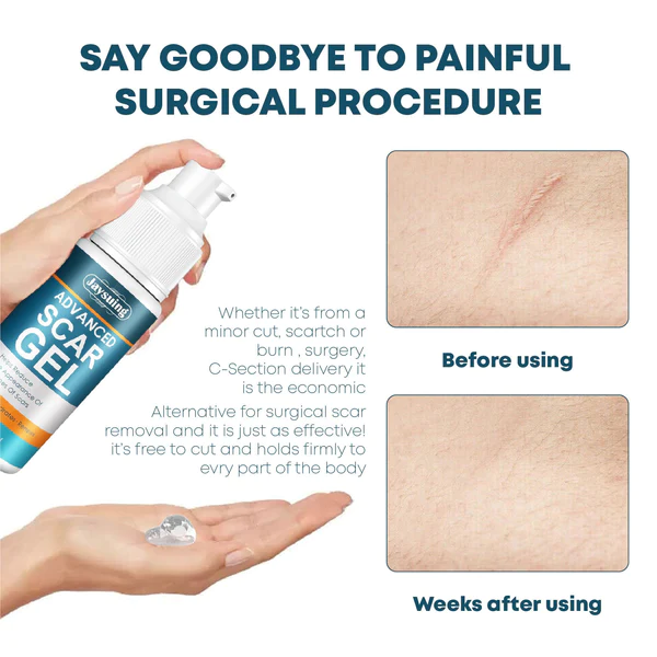 Instant ScarRemoval Advanced Gel