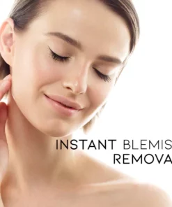 Instant Spots Removal Pen