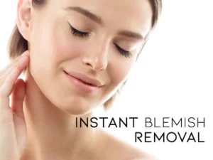 Instant Spots Removal Pen