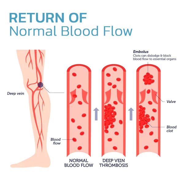 KNEECAX™ Tourmaline Acupressure Selfheating Ծնկաթև