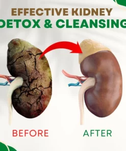 Kidney Support Herbal Foot Soak Kidney Detox