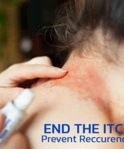 KoTinea Soothing Ointment