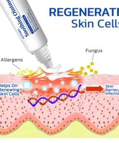 KoTinea Soothing Ointment