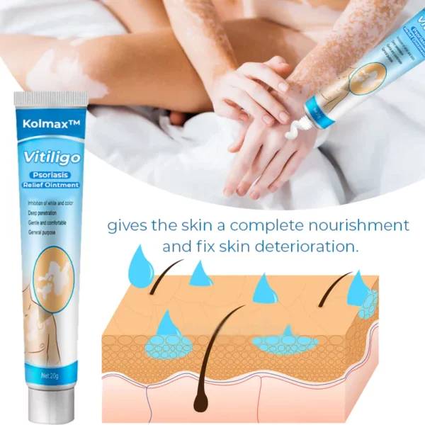 Kolmax™ Vitiligo beruhigende Salbe