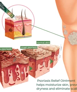 Kolmax™ Psoriasis Soothing Ointment