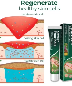Kolmax™ Psoriasis Soothing Ointment