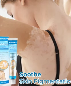 Kolmax™ Vitiligo Soothing Ointment