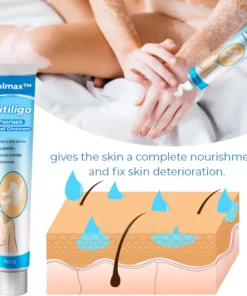 Kolmax™ Vitiligo Soothing Ointment