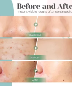 Korea Skin Formula - Green Tea Mask Bar