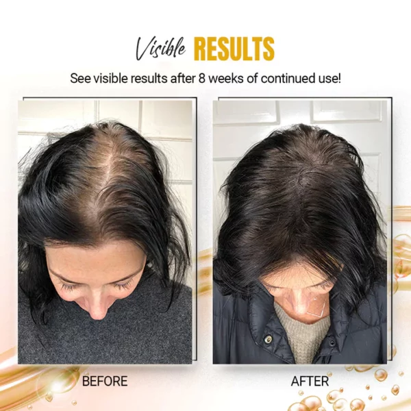 Kuse-Scene™ Japanese Rice Water Hair SerumMist