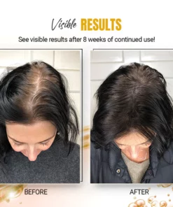 Kuse-Scene™ Japanese Rice Water Hair SerumMist