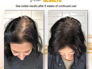 Kuse-Scene™ Japanese Rice Water Hair SerumMist