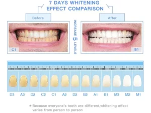 LAFEIGE NePLUS Teeth Whitening Tooth Essence