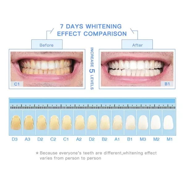 LAFEIGE NePLUS Blanchiment des Dents Essence Dentaire