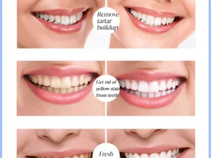 LAFEIGE NePLUS Teeth Whitening Tooth Essence