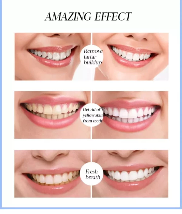 LAFEIGE NePLUS Blanqueamiento Dental Esencia Dental