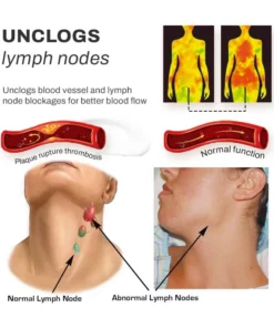 LUMPCare LipomaRemoval HerbalDetox Cream