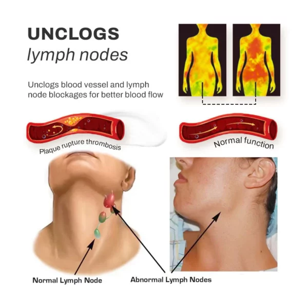 LUMPCare Lipoma Removal HerbalDetox ڪريم