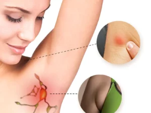 LUMPCare LipomaRemoval HerbalDetox Cream