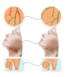 LUMPCare LipomaRemoval HerbalDetox Cream