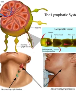 LipomaCure™ Detox Cream