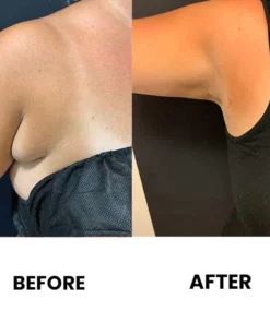 LipomaCure™ Detox Cream