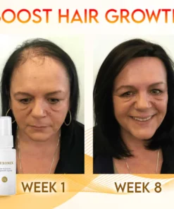 Luxonix Hair Nutrition Regrowth Spray